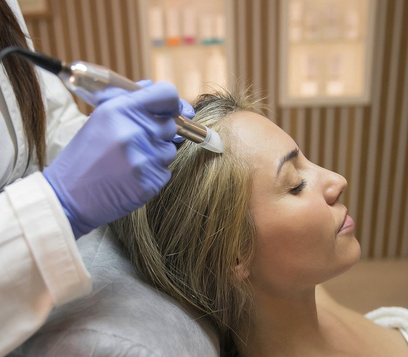 Tratamiento capilar para la caida del pelo